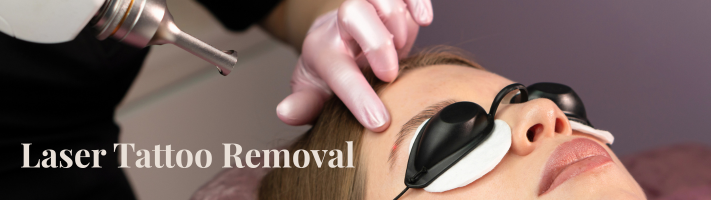 Laser Tattoo Removal (711 x 200 px)